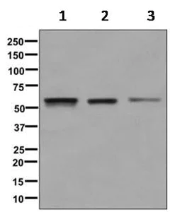 Western blot - Anti-PTEN antibody [EPR9941-2] (AB170941)