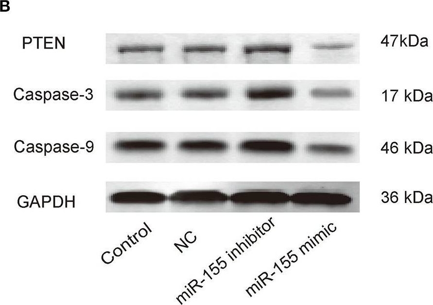 Western blot - Anti-PTEN antibody [EPR9941-2] (ab170941), expandable thumbnail