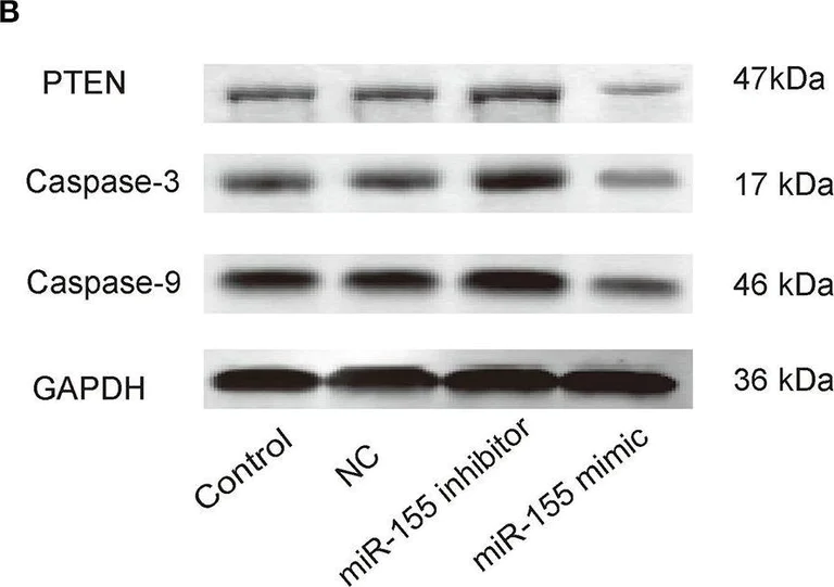 Western blot - Anti-PTEN antibody [EPR9941-2] (AB170941)