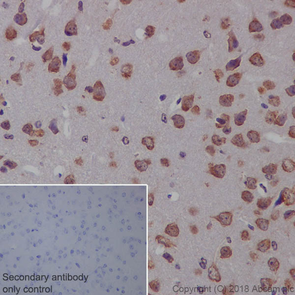 Immunohistochemistry (Formalin/PFA-fixed paraffin-embedded sections) - Anti-PTEN antibody [EPR9941-2] - BSA and Azide free (AB271924), expandable thumbnail