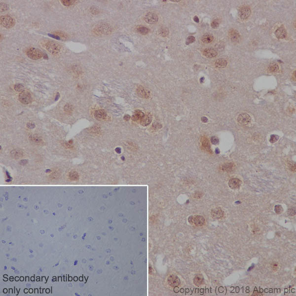 Immunohistochemistry (Formalin/PFA-fixed paraffin-embedded sections) - Anti-PTEN antibody [EPR9941-2] - BSA and Azide free (AB271924), expandable thumbnail