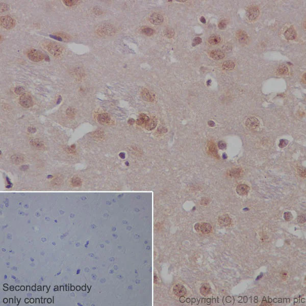 Immunohistochemistry (Formalin/PFA-fixed paraffin-embedded sections) - Anti-PTEN antibody [EPR9941-2] - BSA and Azide free (AB271924)