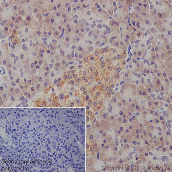 Immunohistochemistry (Formalin/PFA-fixed paraffin-embedded sections) - Anti-PTEN antibody [EPR9941-2] - BSA and Azide free (AB271924), expandable thumbnail