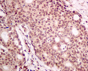 Immunohistochemistry (Formalin/PFA-fixed paraffin-embedded sections) - Anti-PTEN antibody [EPR9941-2] - BSA and Azide free (ab271924), expandable thumbnail
