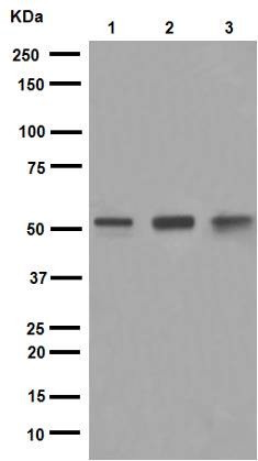 Western blot - Anti-PTEN antibody [EPR9941] (AB154812), expandable thumbnail