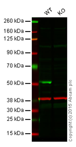 Western blot - Anti-PTEN antibody [EPR9941] (AB154812), expandable thumbnail