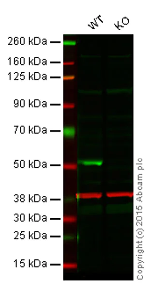 Western blot - Anti-PTEN antibody [EPR9941] (AB154812)