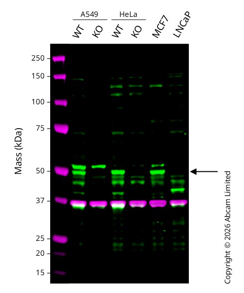 Western blot - Anti-PTEN antibody [EPR9941] (AB154812)