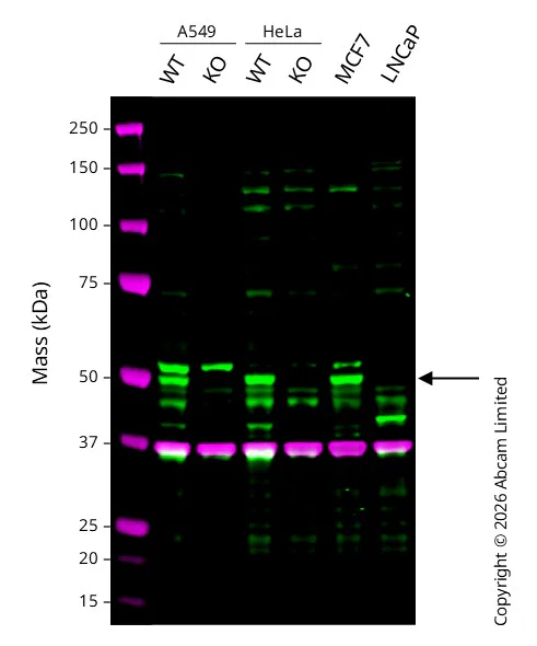 Western blot - Anti-PTEN antibody [EPR9941] (AB154812)