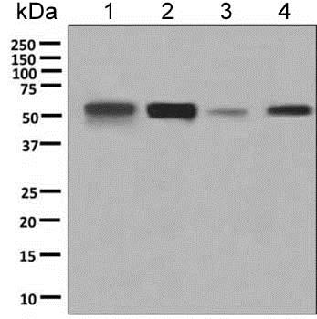 Western blot - Anti-PTEN antibody [EPR9941] (AB154812), expandable thumbnail