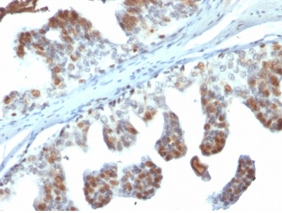 Immunohistochemistry (Formalin/PFA-fixed paraffin-embedded sections) - Anti-PTEN antibody [PTEN/2110] (AB238032), expandable thumbnail