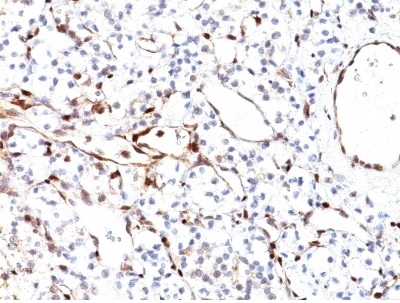 Immunohistochemistry (Formalin/PFA-fixed paraffin-embedded sections) - Anti-PTEN antibody [PTEN/2110] (AB238032), expandable thumbnail