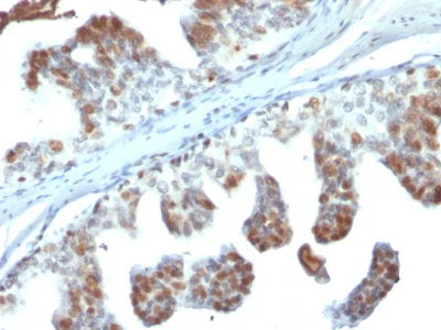 Immunohistochemistry (Formalin/PFA-fixed paraffin-embedded sections) - Anti-PTEN antibody [PTEN/2110] - BSA and Azide free (AB237878)