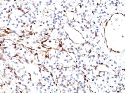 Immunohistochemistry (Formalin/PFA-fixed paraffin-embedded sections) - Anti-PTEN antibody [PTEN/2110] - BSA and Azide free (AB237878)