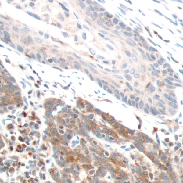 Immunohistochemistry (Formalin/PFA-fixed paraffin-embedded sections) - Anti-PTEN antibody [SP170] - BSA and Azide free (ab272009), expandable thumbnail