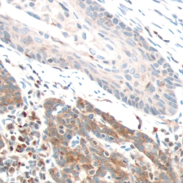 Immunohistochemistry (Formalin/PFA-fixed paraffin-embedded sections) - Anti-PTEN antibody [SP170] - BSA and Azide free (AB272009)