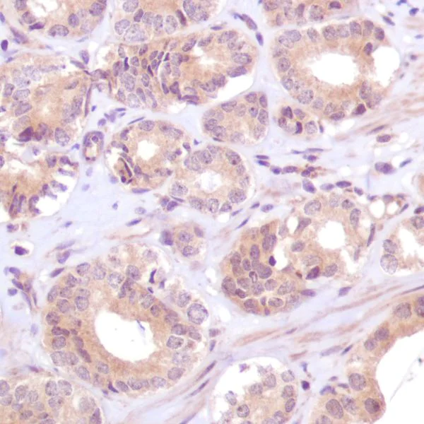 Immunohistochemistry (Formalin/PFA-fixed paraffin-embedded sections) - Anti-PTEN antibody [SP170] - BSA and Azide free (AB272009)