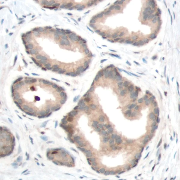 Immunohistochemistry (Formalin/PFA-fixed paraffin-embedded sections) - Anti-PTEN antibody [SP170] - BSA and Azide free (AB272009)