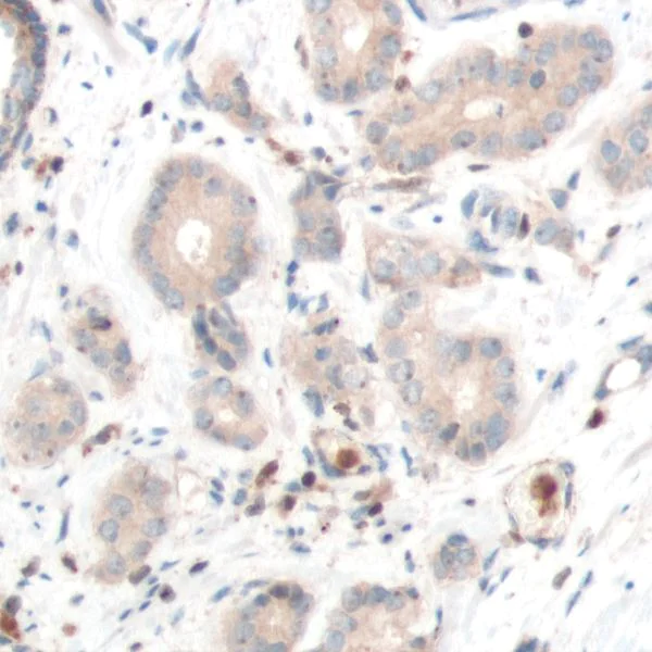 Immunohistochemistry (Formalin/PFA-fixed paraffin-embedded sections) - Anti-PTEN antibody [SP170] - BSA and Azide free (AB272009)