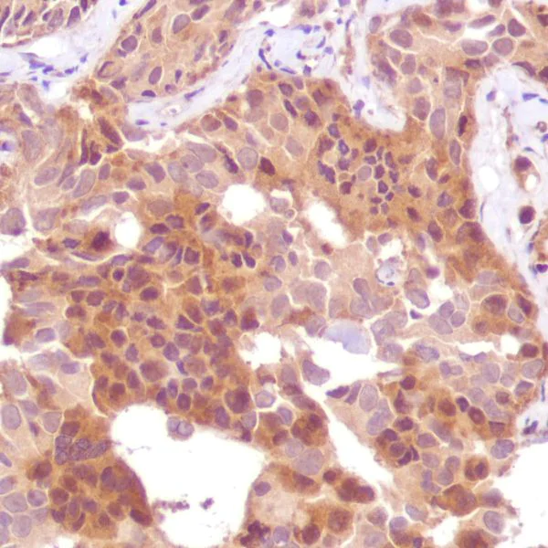 Immunohistochemistry (Formalin/PFA-fixed paraffin-embedded sections) - Anti-PTEN antibody [SP170] - BSA and Azide free (AB272009)