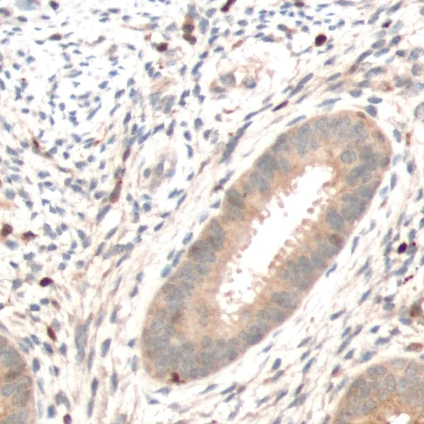 Immunohistochemistry (Formalin/PFA-fixed paraffin-embedded sections) - Anti-PTEN antibody [SP170] - BSA and Azide free (AB272009)