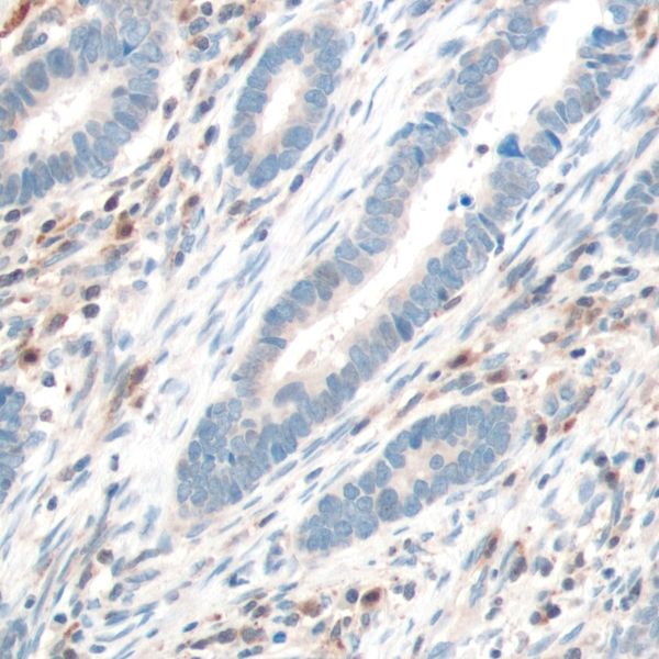 Immunohistochemistry (Formalin/PFA-fixed paraffin-embedded sections) - Anti-PTEN antibody [SP170] - BSA and Azide free (ab272009), expandable thumbnail