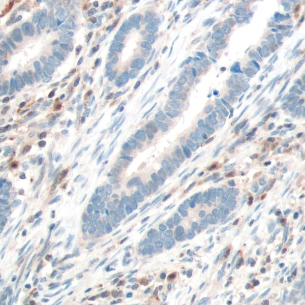Immunohistochemistry (Formalin/PFA-fixed paraffin-embedded sections) - Anti-PTEN antibody [SP170] - BSA and Azide free (AB272009)
