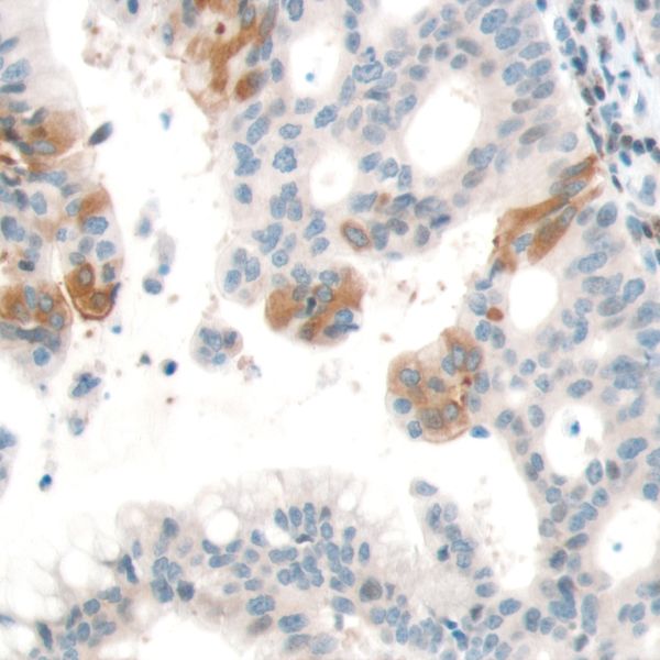 Immunohistochemistry (Formalin/PFA-fixed paraffin-embedded sections) - Anti-PTEN antibody [SP170] - BSA and Azide free (ab272009), expandable thumbnail