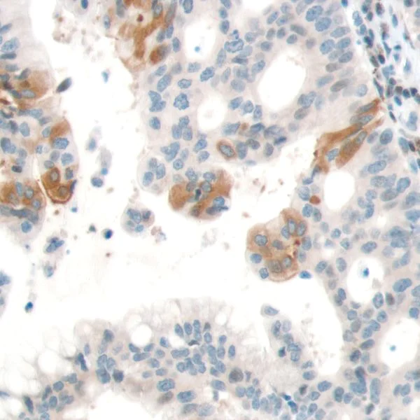 Immunohistochemistry (Formalin/PFA-fixed paraffin-embedded sections) - Anti-PTEN antibody [SP170] - BSA and Azide free (AB272009)