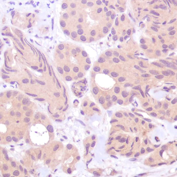 Immunohistochemistry (Formalin/PFA-fixed paraffin-embedded sections) - Anti-PTEN antibody [SP170] - BSA and Azide free (AB272009)