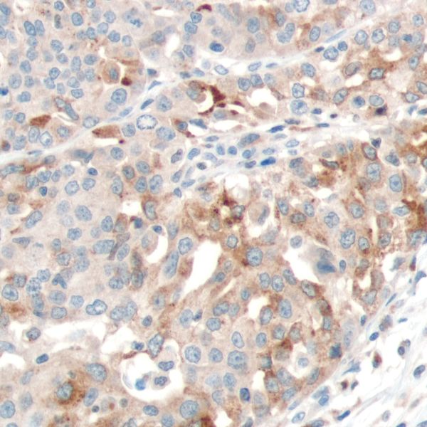 Immunohistochemistry (Formalin/PFA-fixed paraffin-embedded sections) - Anti-PTEN antibody [SP170] - BSA and Azide free (ab272009), expandable thumbnail