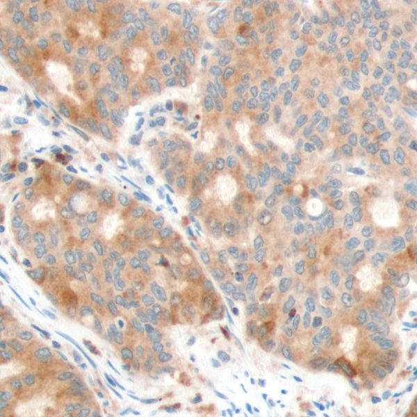 Immunohistochemistry (Formalin/PFA-fixed paraffin-embedded sections) - Anti-PTEN antibody [SP170] - N-terminal (ab227657), expandable thumbnail