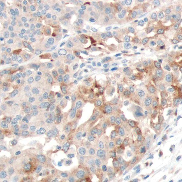 Immunohistochemistry (Formalin/PFA-fixed paraffin-embedded sections) - Anti-PTEN antibody [SP170] - N-terminal (AB227657)