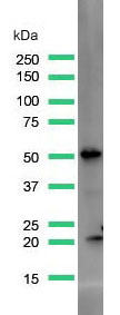 Western blot - Anti-PTEN antibody [SP170] - N-terminal (AB227657), expandable thumbnail