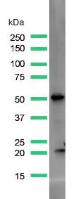 Western blot - Anti-PTEN antibody [SP170] - N-terminal (AB227657)