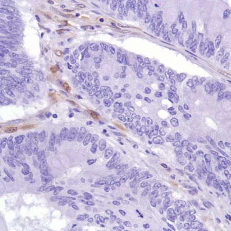 Immunohistochemistry (Formalin/PFA-fixed paraffin-embedded sections) - Anti-PTEN antibody [SP218] - BSA and Azide free (AB243940), expandable thumbnail