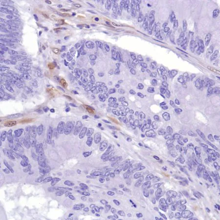 Immunohistochemistry (Formalin/PFA-fixed paraffin-embedded sections) - Anti-PTEN antibody [SP218] - BSA and Azide free (AB243940)