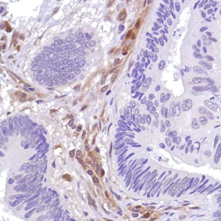 Immunohistochemistry (Formalin/PFA-fixed paraffin-embedded sections) - Anti-PTEN antibody [SP218] - BSA and Azide free (AB243940)