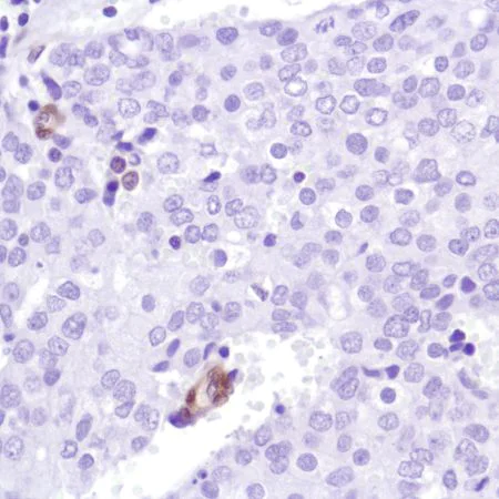 Immunohistochemistry (Formalin/PFA-fixed paraffin-embedded sections) - Anti-PTEN antibody [SP218] - BSA and Azide free (AB243940)