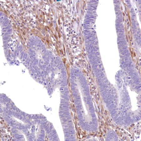 Immunohistochemistry (Formalin/PFA-fixed paraffin-embedded sections) - Anti-PTEN antibody [SP218] - BSA and Azide free (AB243940)