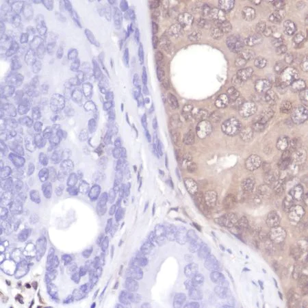Immunohistochemistry (Formalin/PFA-fixed paraffin-embedded sections) - Anti-PTEN antibody [SP218] - BSA and Azide free (AB243940)