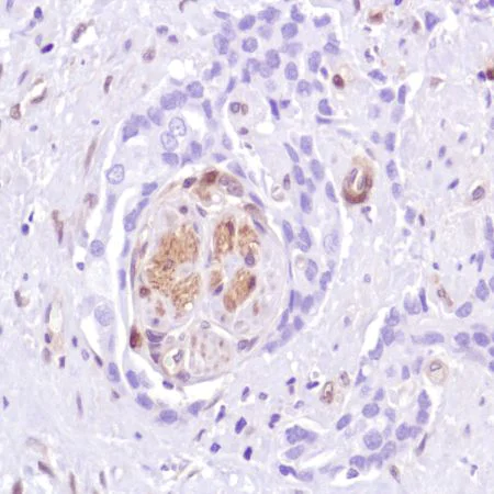 Immunohistochemistry (Formalin/PFA-fixed paraffin-embedded sections) - Anti-PTEN antibody [SP218] - BSA and Azide free (AB243940)