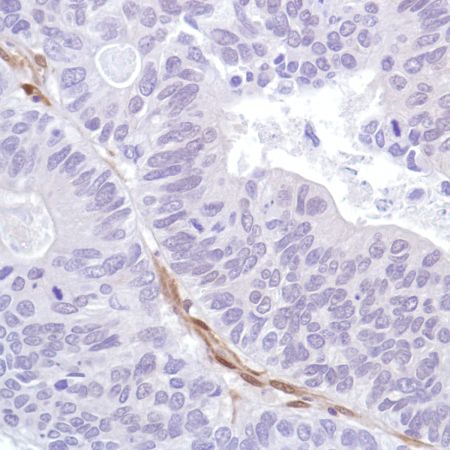 Immunohistochemistry (Formalin/PFA-fixed paraffin-embedded sections) - Anti-PTEN antibody [SP218] - BSA and Azide free (AB243940), expandable thumbnail