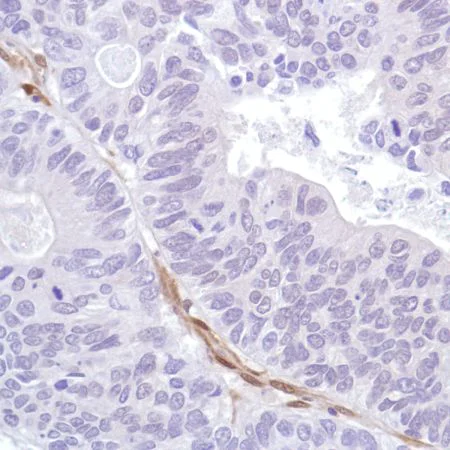 Immunohistochemistry (Formalin/PFA-fixed paraffin-embedded sections) - Anti-PTEN antibody [SP218] - BSA and Azide free (AB243940)