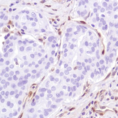 Immunohistochemistry (Formalin/PFA-fixed paraffin-embedded sections) - Anti-PTEN antibody [SP218] - BSA and Azide free (ab243940), expandable thumbnail