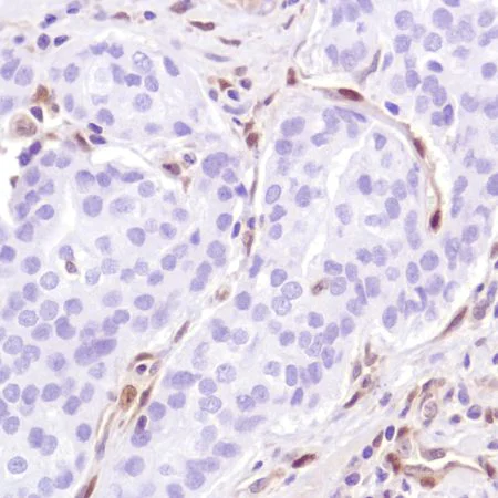 Immunohistochemistry (Formalin/PFA-fixed paraffin-embedded sections) - Anti-PTEN antibody [SP218] - BSA and Azide free (AB243940)
