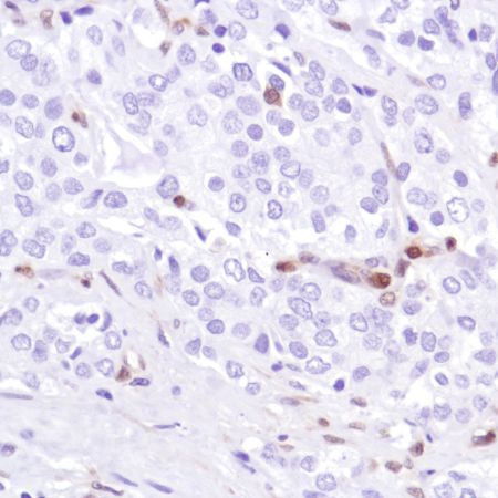 Immunohistochemistry (Formalin/PFA-fixed paraffin-embedded sections) - Anti-PTEN antibody [SP218] - BSA and Azide free (ab243940), expandable thumbnail