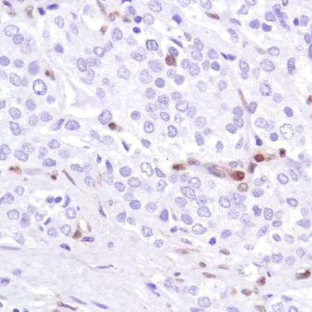 Immunohistochemistry (Formalin/PFA-fixed paraffin-embedded sections) - Anti-PTEN antibody [SP218] - BSA and Azide free (AB243940)