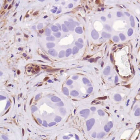 Immunohistochemistry (Formalin/PFA-fixed paraffin-embedded sections) - Anti-PTEN antibody [SP218] - BSA and Azide free (ab243940), expandable thumbnail