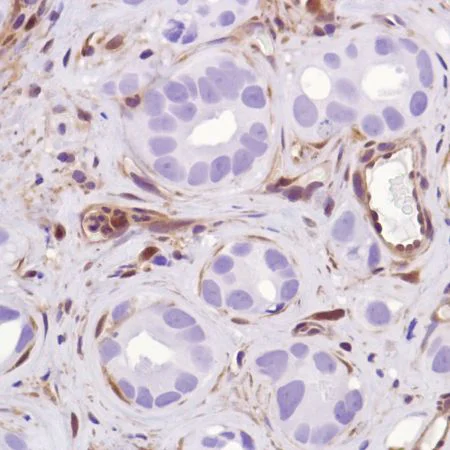 Immunohistochemistry (Formalin/PFA-fixed paraffin-embedded sections) - Anti-PTEN antibody [SP218] - BSA and Azide free (AB243940)
